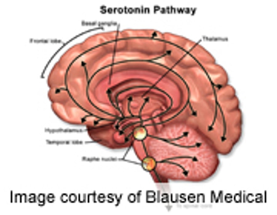 Serotonin1A Binding Linked to Suicide Attempt Lethality