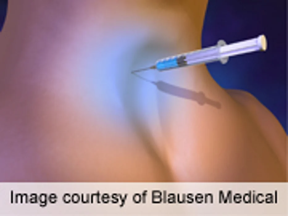 Core Needle Biopsy Helpful With Cervical Lymphadenopathy