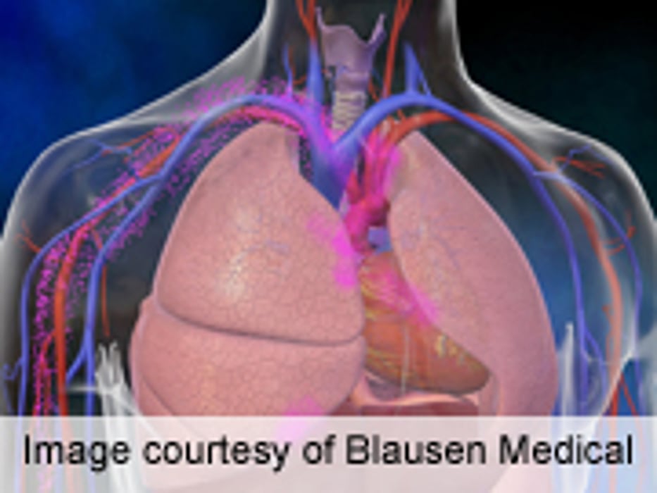 High Yield With Radiologist Recommendation for Chest CT