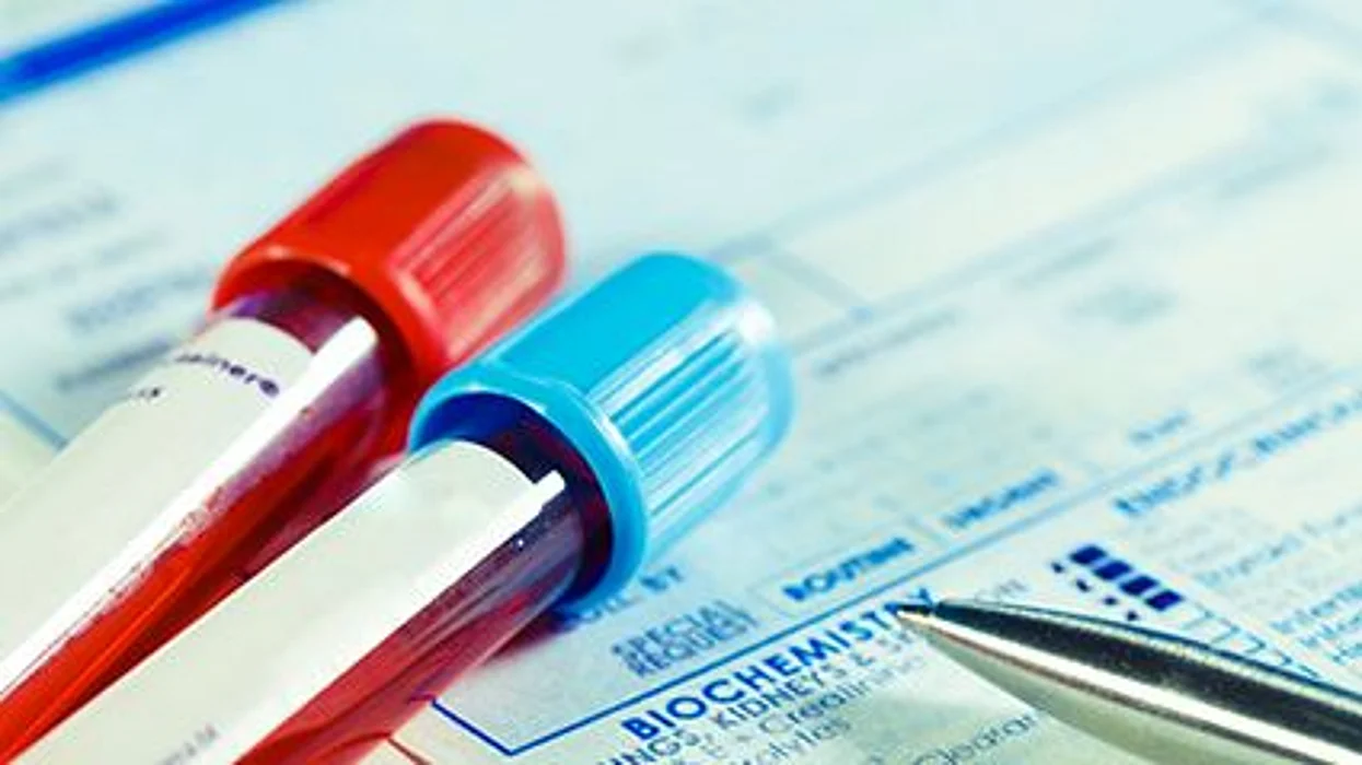 El colesterol y las enfermedades cardiacas