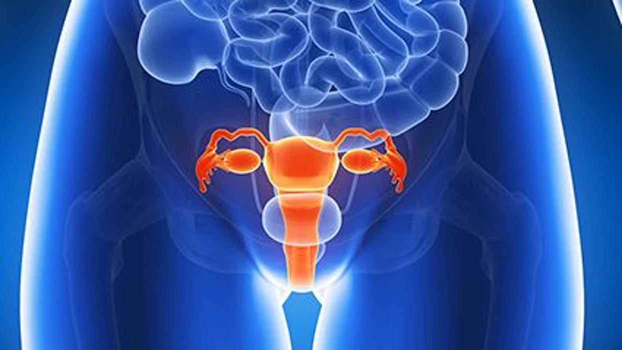 El café y el riesgo de cáncer de endometrio