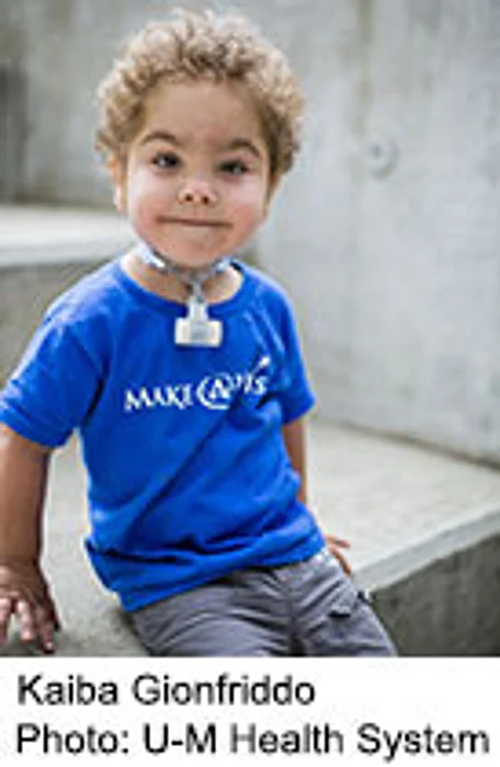 3D 'Printout' Device Keeps Very Ill Babies Breathing