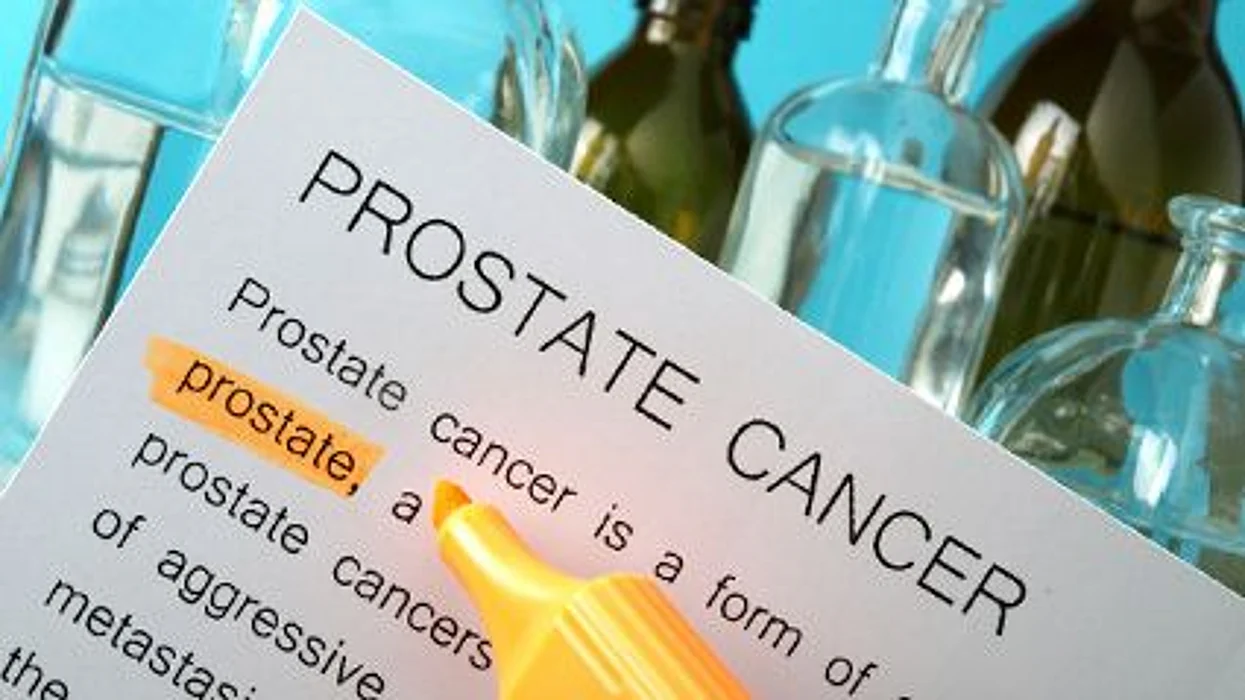 El cáncer de la próstata y el peso