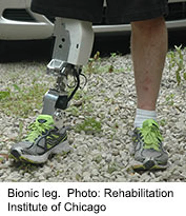Progress Toward Intuitive Motorized Prosthetic Lower Leg