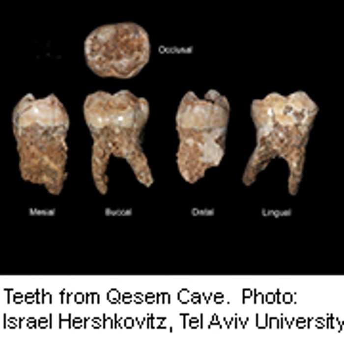 Ancient Teeth Show Signs of Indoor Air Pollution