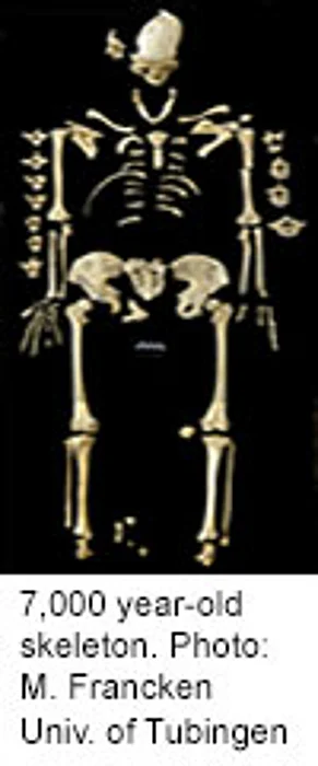 She Had Leukemia 7,000 Years Ago