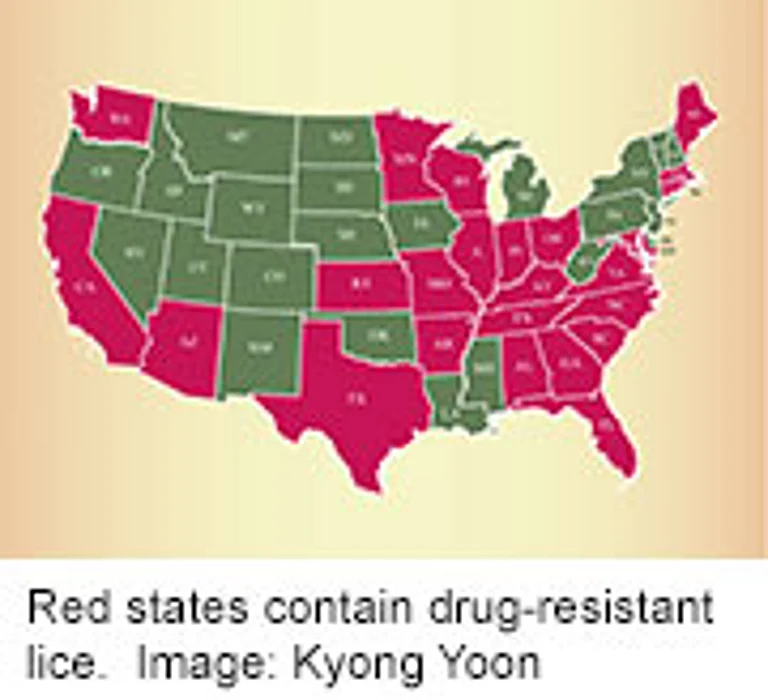 Head Lice Now Resistant to Common Meds in 25 States