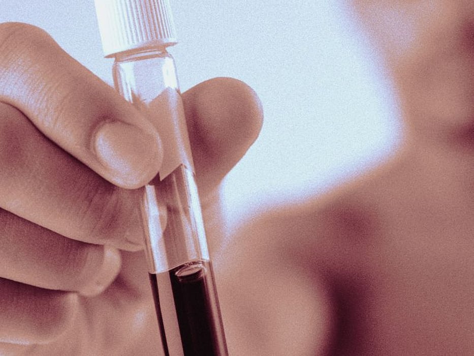 Prognostic Biomarkers ID'd in Pulmonary Hypertension