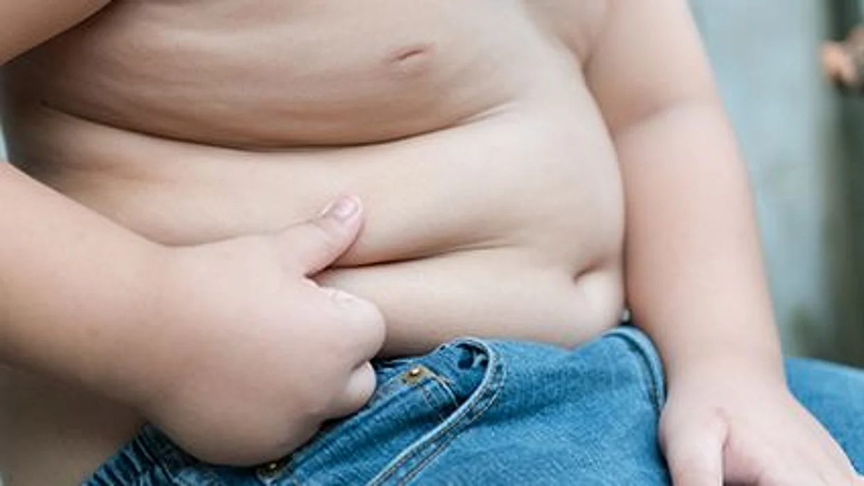 Los efectos sobre la salud de la obesidad severa en la niñez