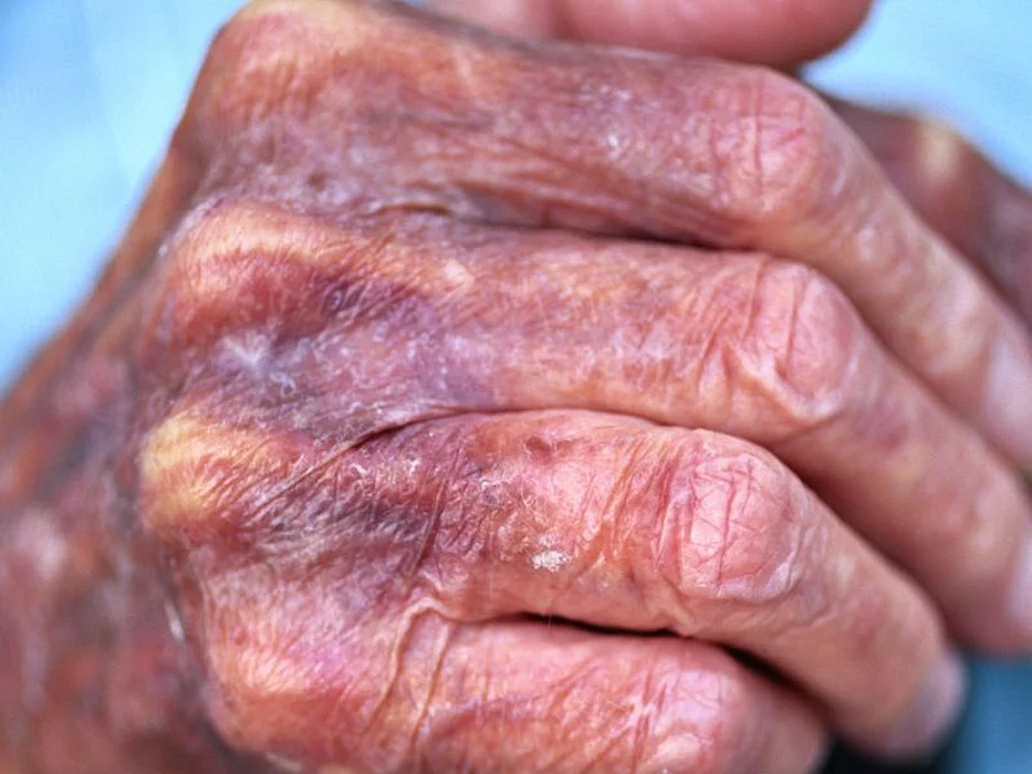 Dying at Home Brings More Peace Without More Pain, Study Finds