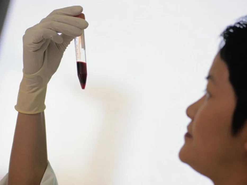 Molecular Autopsy Finds Cause in 40 Percent of Unexpected Deaths