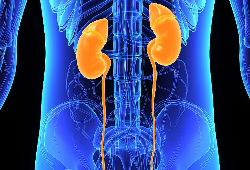 Kidney Stone Incidence Increased Between 1984 and 2012