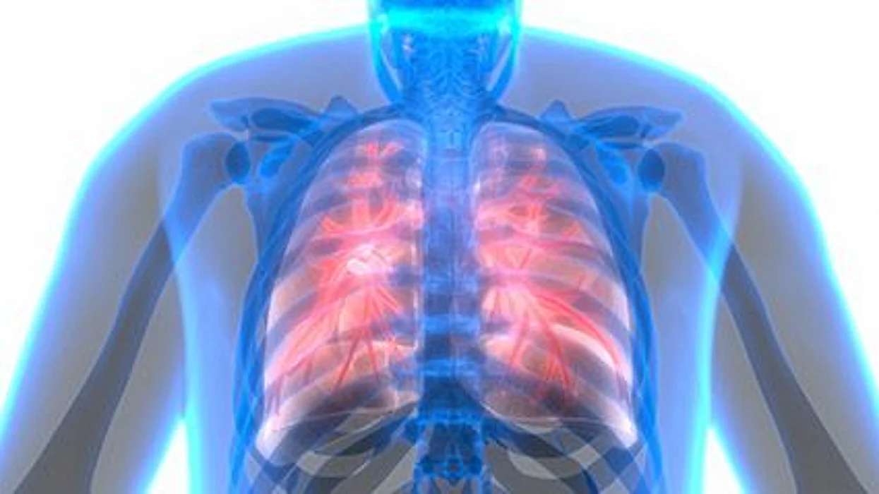 El tratamiento de las enfermedades respiratorias crónicas