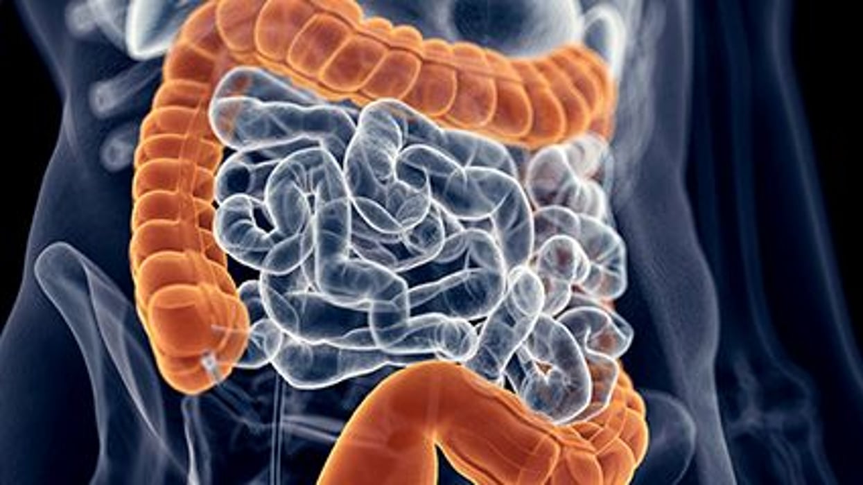 An Update On Colorectal Cancer Screening