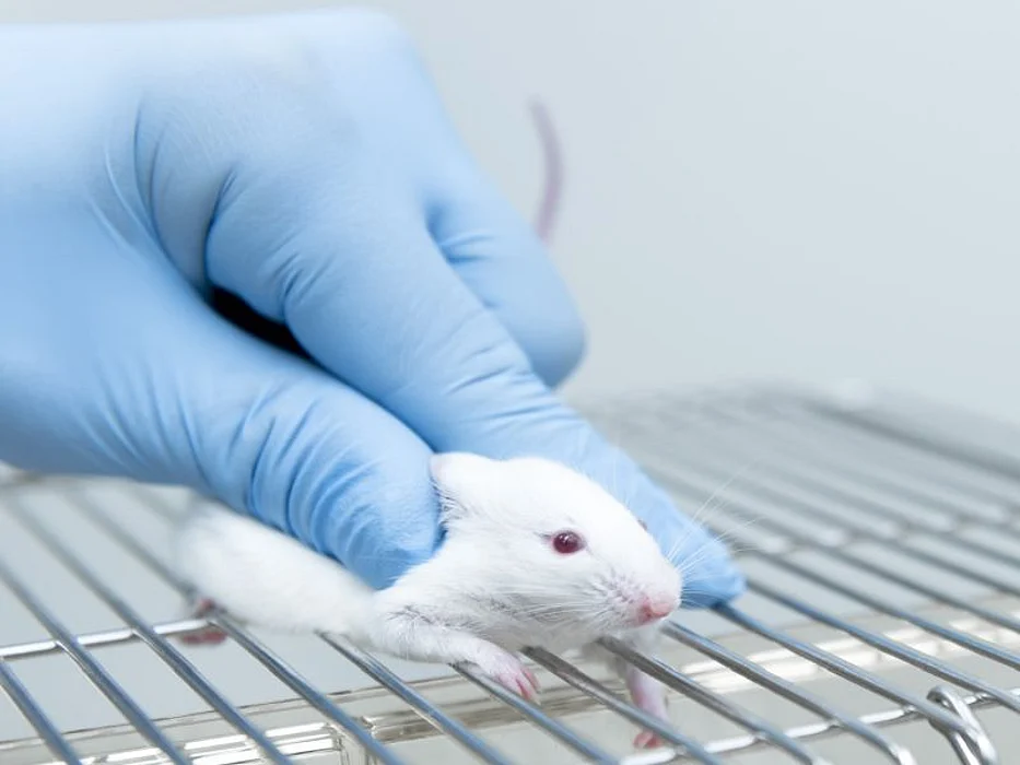 Scientists Spot Gene Linking Down Syndrome, Early Alzheimer's