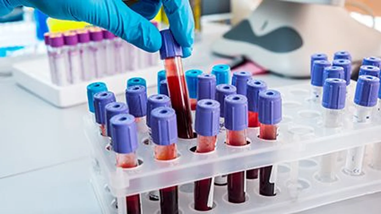 Centers for Disease Control and Prevention