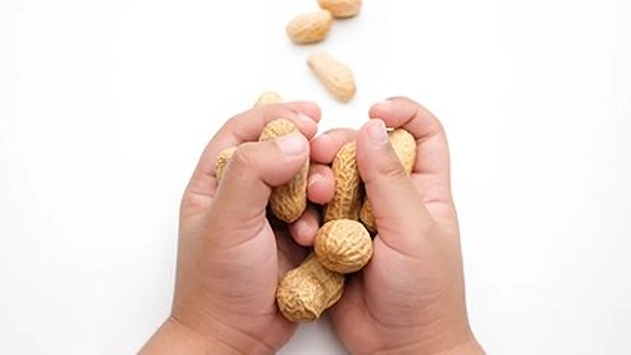 More Kids With Nut Allergies End Up In The ED During These Two Major Holidays, Study Finds.