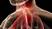 Esophageal Cancer On The Rise In Younger Adults