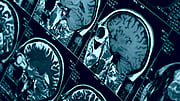 COVID-19 Is Causing Serious Eye Problems In Some Patients: Study