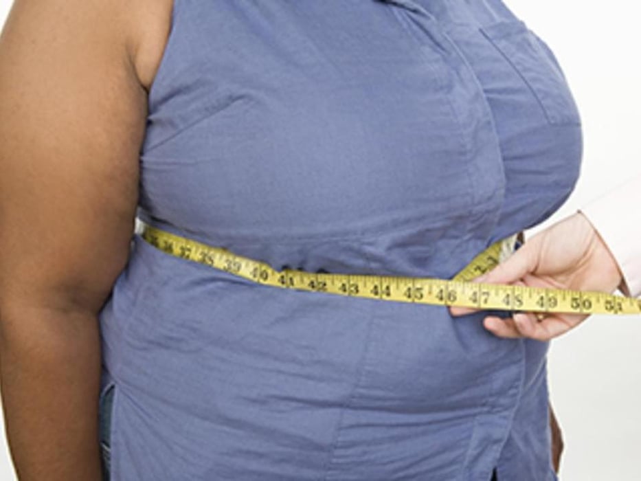 女性の隠れ肥満は過活動膀胱のリスクの可能性 長崎大 Consumer Health News Healthday