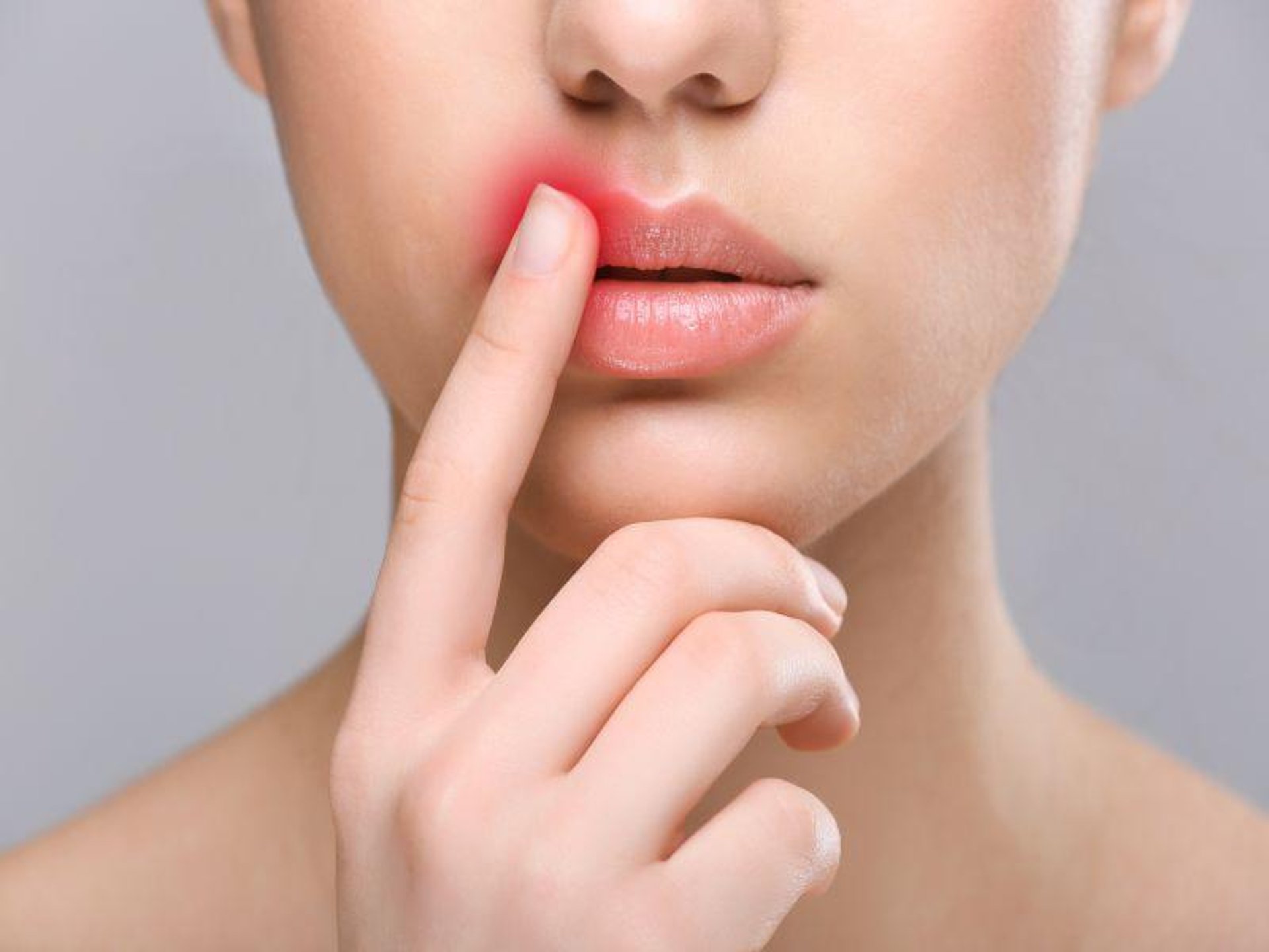 What Causes Herpes Cold Sore Flare-Ups? New Study Offers Clues thumbnail