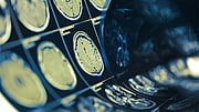 Concussions Linked To Long-Term Sleep Disorders