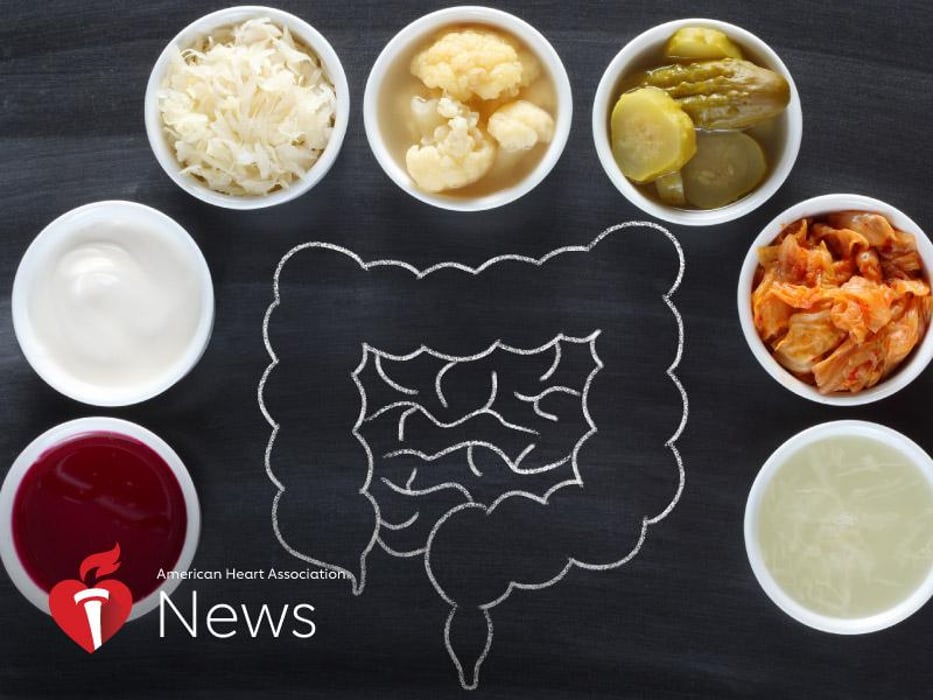 AHA News: A medida que aumenta la popularidad de los alimentos fermentados, esto es lo que dicen los expertos