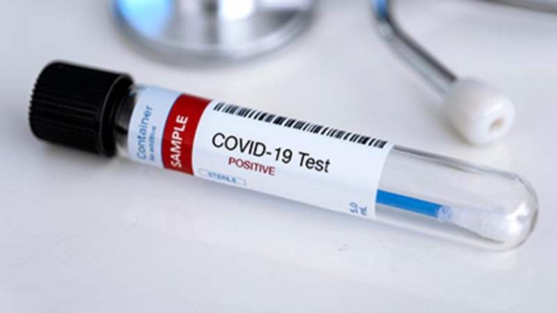 Heart Complications After COVID-19 Are Rare In College Athletes, New Study Finds