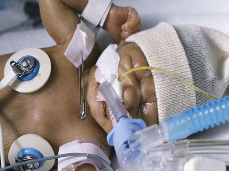 Skin-to-Skin Contact Could Boost Survival of Very Premature Babies