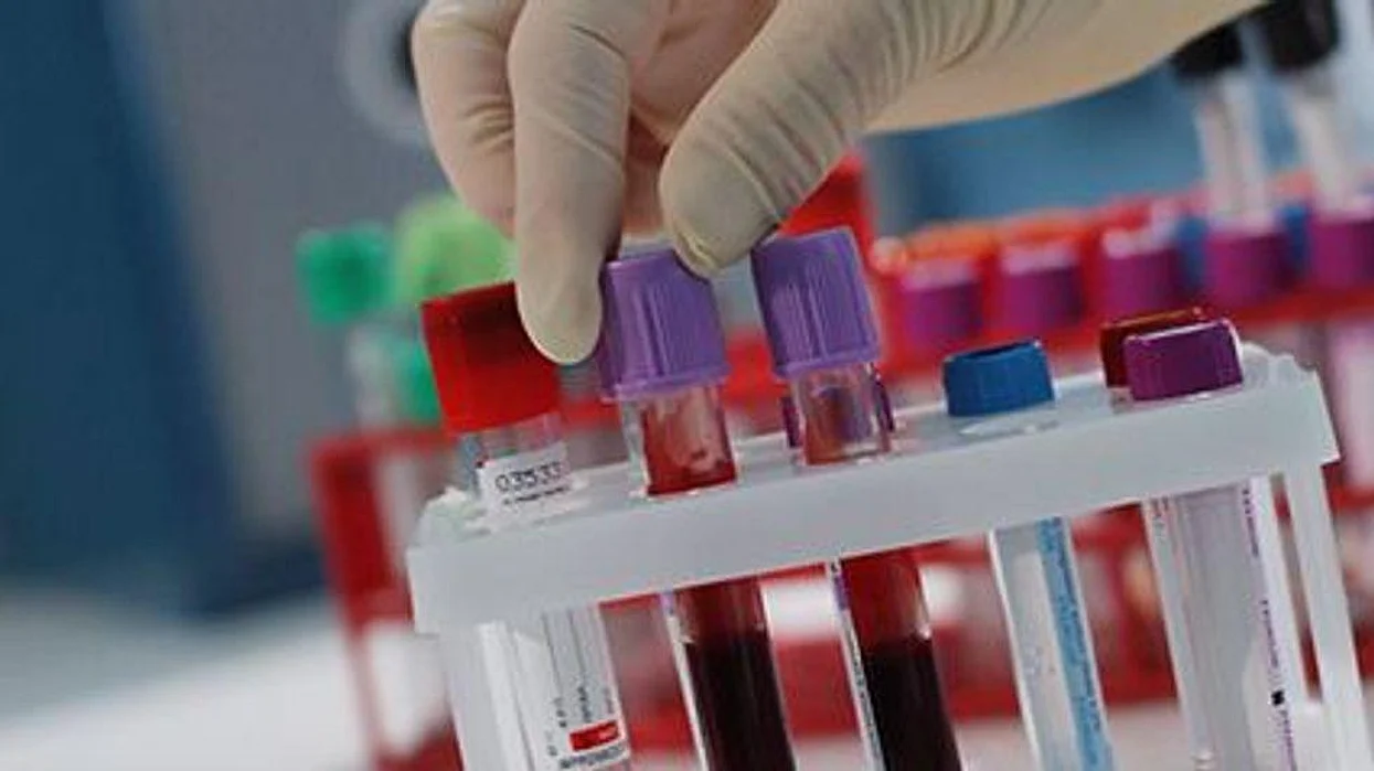cancer screening