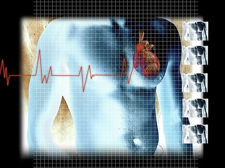 heart model