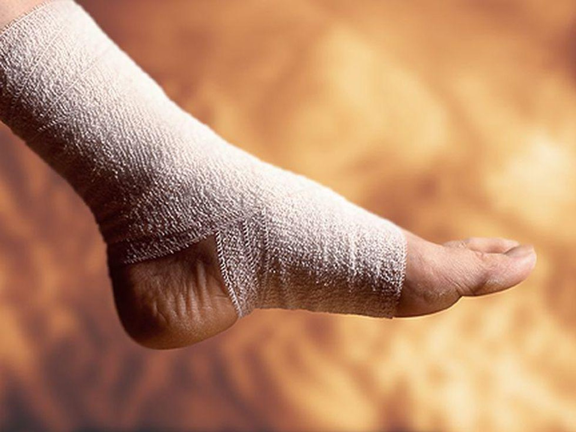 News Picture: What Surgery Works Best for Advanced Ankle Arthritis?