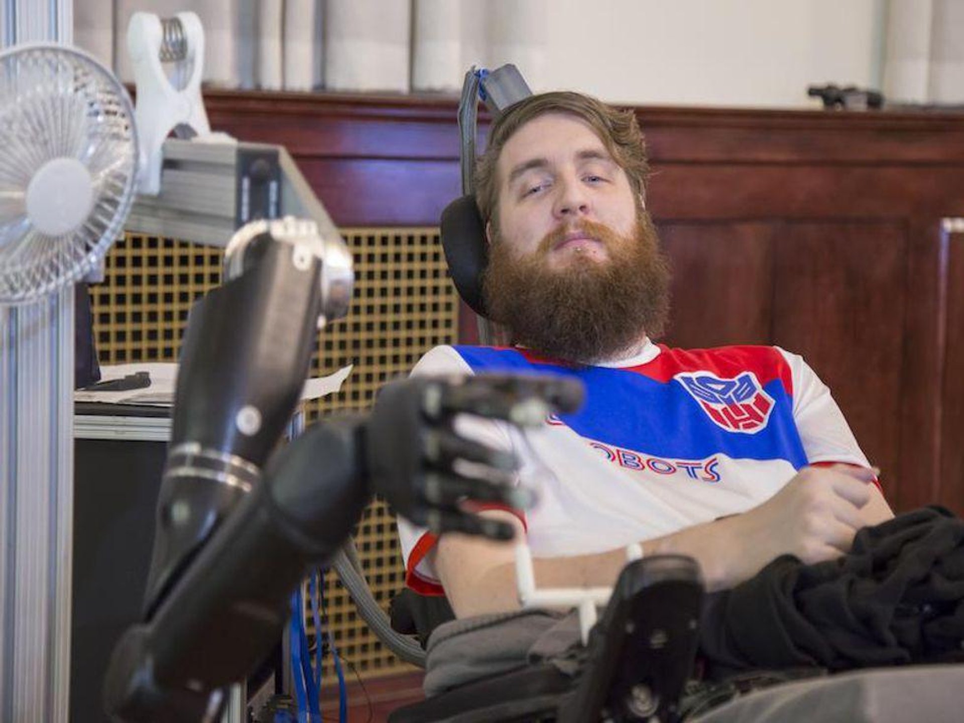 News Picture: Man's Robotic Arm Works Faster With High-Tech Sense of Touch