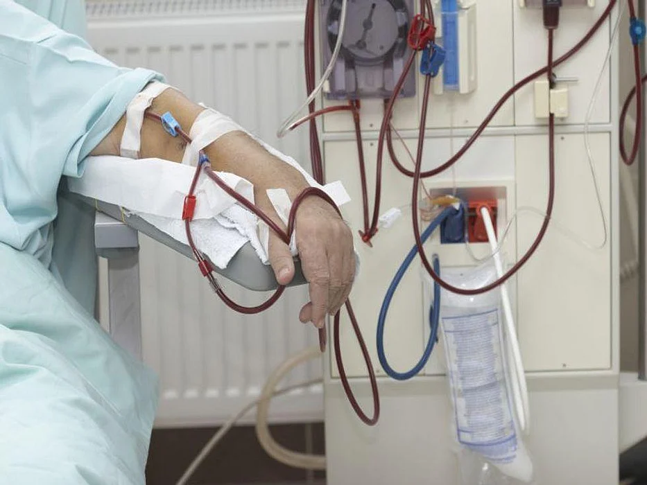 Factors ID'd for COVID-19 Infection Risk in Dialysis Patients