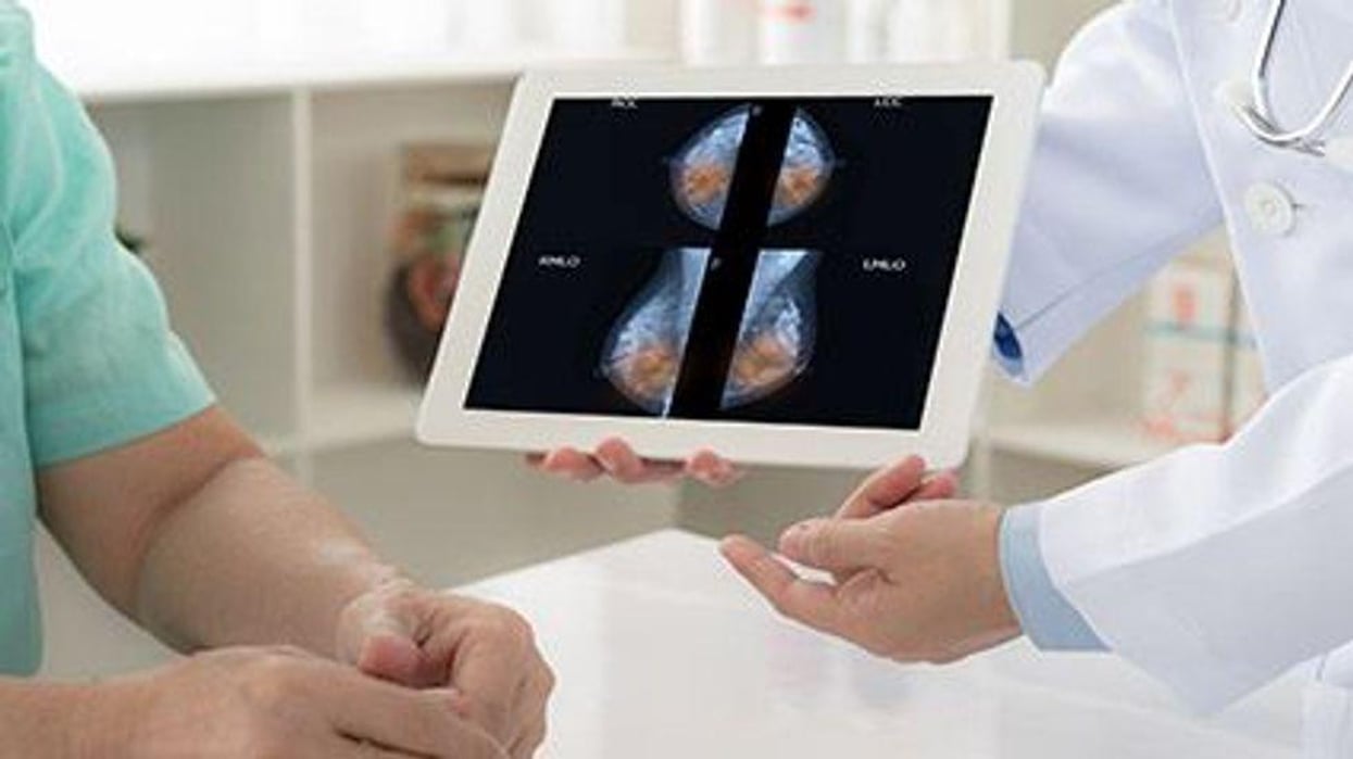 breast scan images