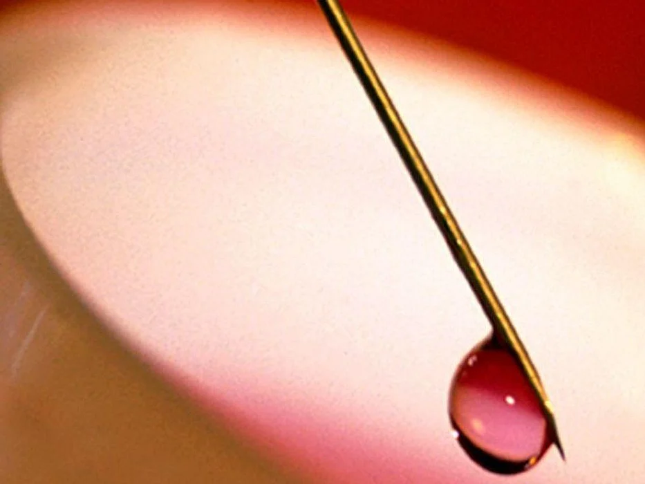 Stem Cell Transplant Reviewed for Peripheral T-Cell Lymphoma