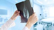 Having Sufficient Vitamin D Improves Breast Cancer Outcomes, Study Finds