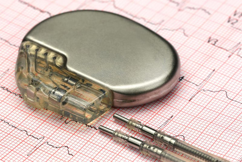 Stress, Anxiety Plague Many Who Get Implanted Heart Devices
