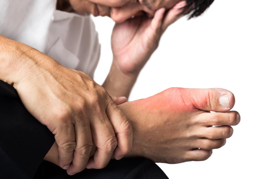 Gout Flare-Ups Could Raise Heart Risk for Weeks After
