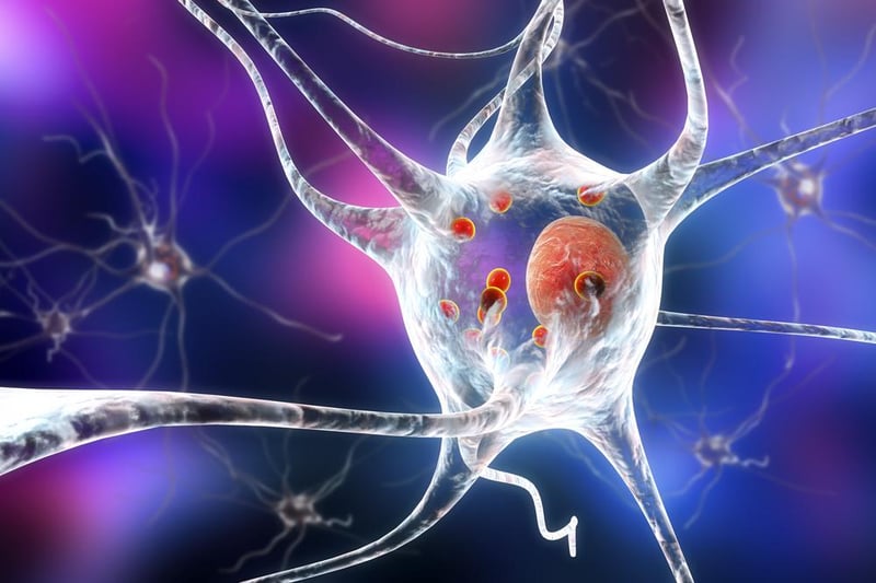 New Form of Levodopa Might Improve Parkinson`s Care