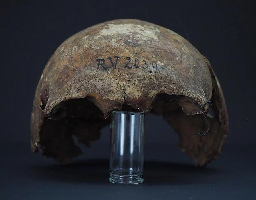 'Black Plague' Was Killing People at Least 5,000 Years Ago