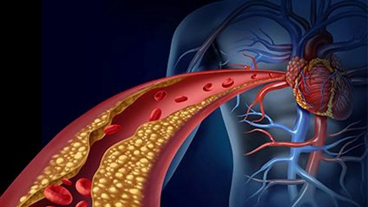 a diagram of a arteries