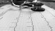 A-Fib After Any Surgery Raises Odds for Heart Failure