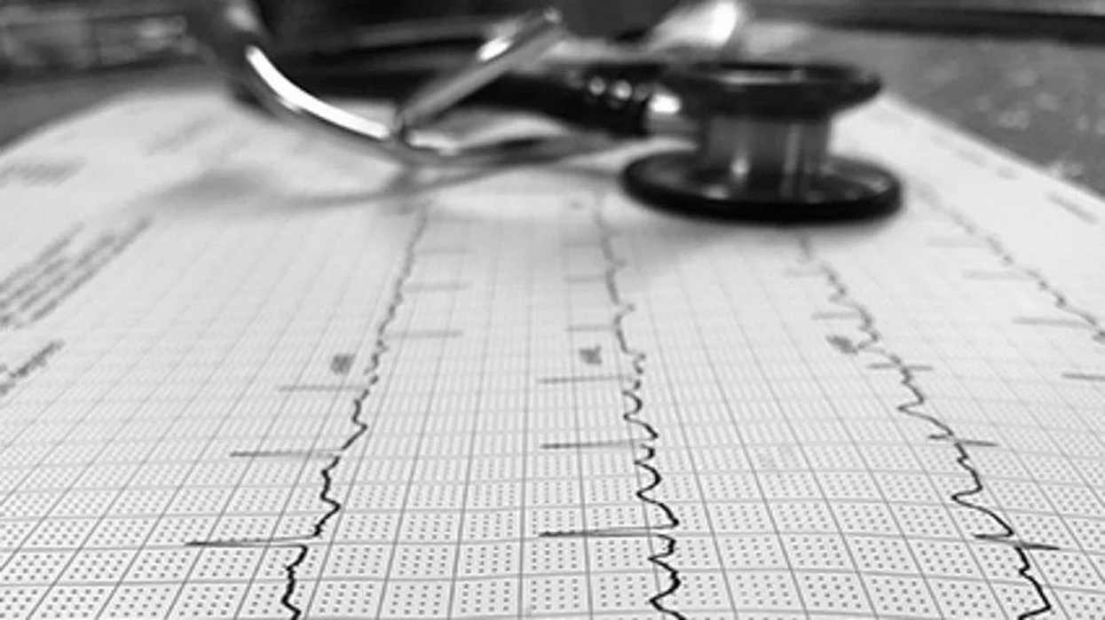 Athletes Have Higher Risk for Developing Atrial Fibrillation