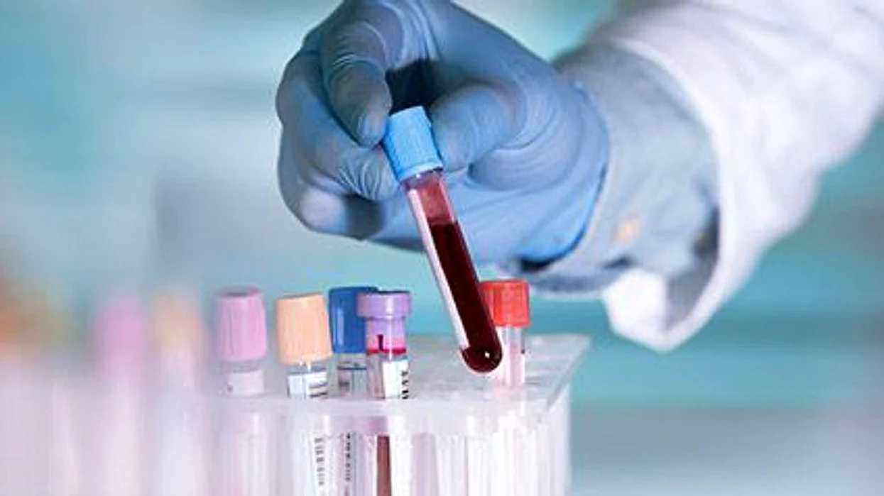 blood samples in a little bottles