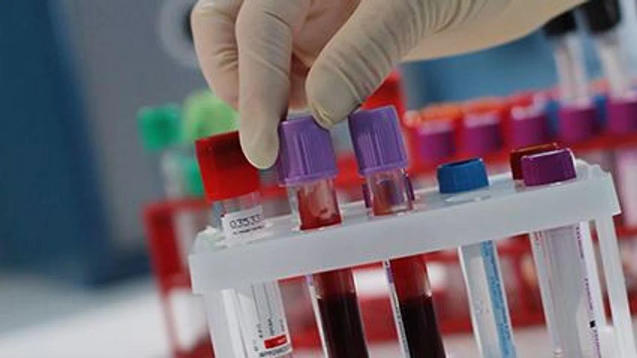 cancer screening