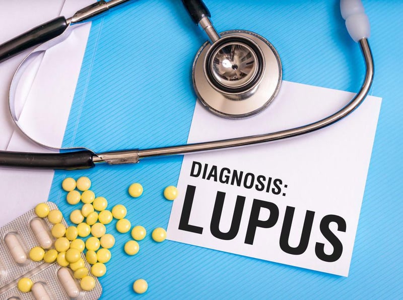 CAR T-Cell Immunotherapy Rids Woman of Tough-to-Treat Lupus
