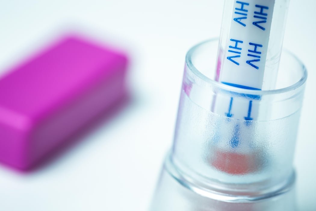 hiv home testing kit consumer health news healthday