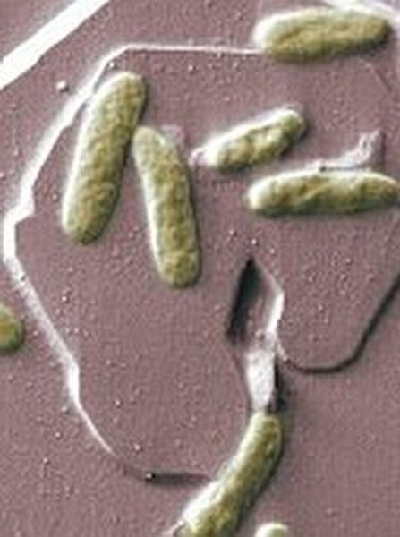 4th Case of Tropical Bacterial Illness Found in United States: CDC