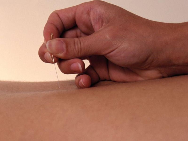 Acupuncture May Help Ease Prostate-Linked Pain in Men: Study
